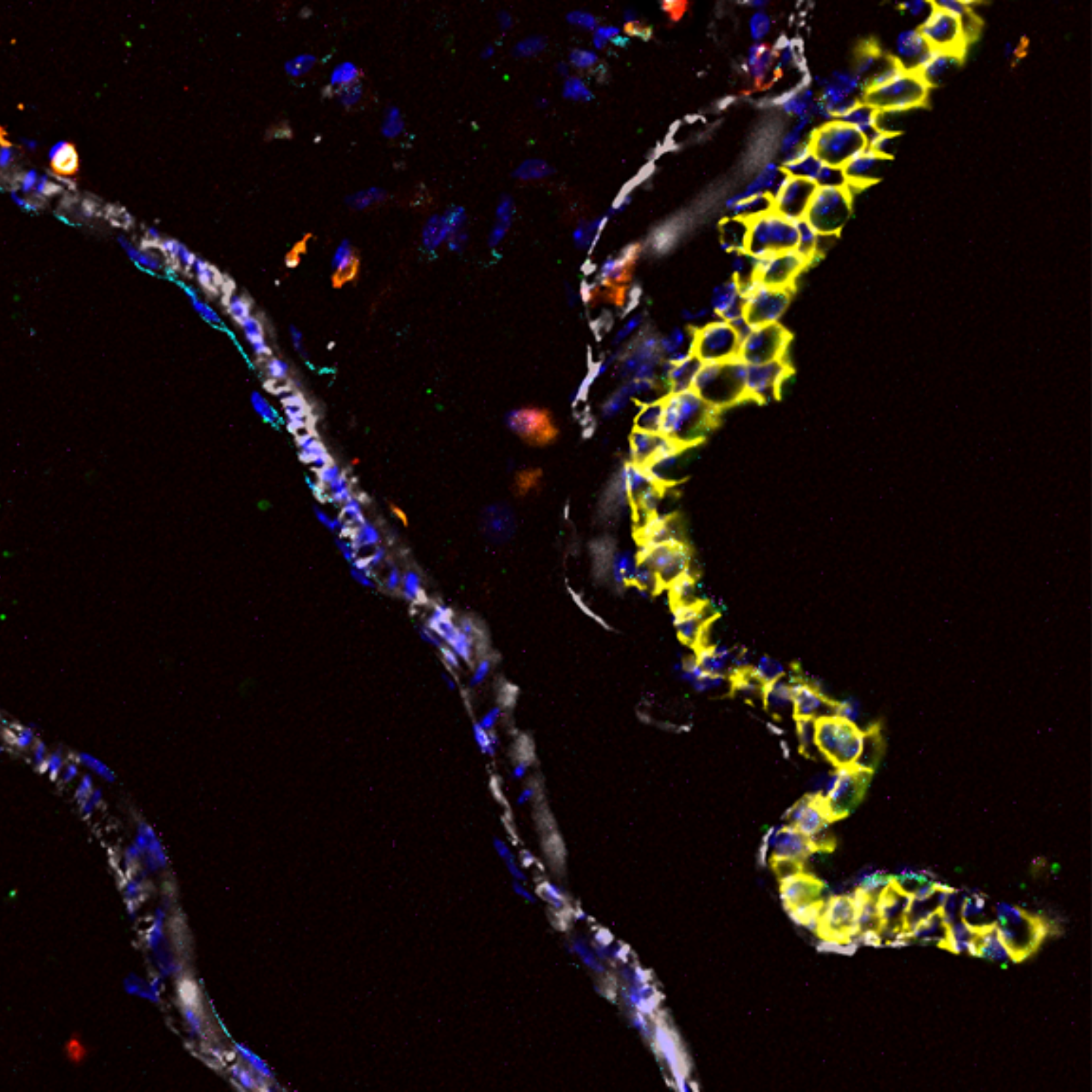 Article_Marichal_ScienceImmuno
