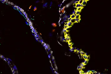 Des vaisseaux sanguins qui éduquent les macrophages des poumons