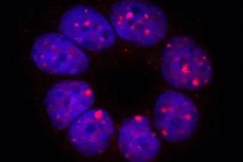 Nouvelle cible pour le traitement des tumeurs du poumon
