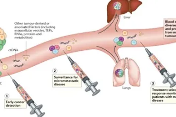 PUBLICATION SCIENTIFIQUE | ? Les biopsies liquides entrent dans la routine clinique 