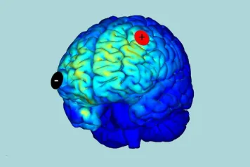 De nouvelles perspectives encourageantes pour le traitement des troubles de la conscience