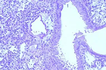 Les monocytes Ly6Chi orchestrent les réponses immunitaires face à des virus respiratoires