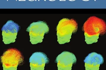 IN MEDIA ?  Le COMA SCIENCE GROUP, dirigé par Steven Laureys, Directeur de recherches FNRS, fait aujourd’hui la couverture de la revue « Annals of Neurology » ! 
