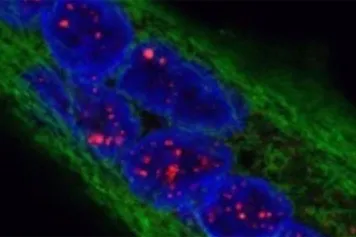 Une nouvelle stratégie thérapeutique potentielle pour la maladie de Steinert
