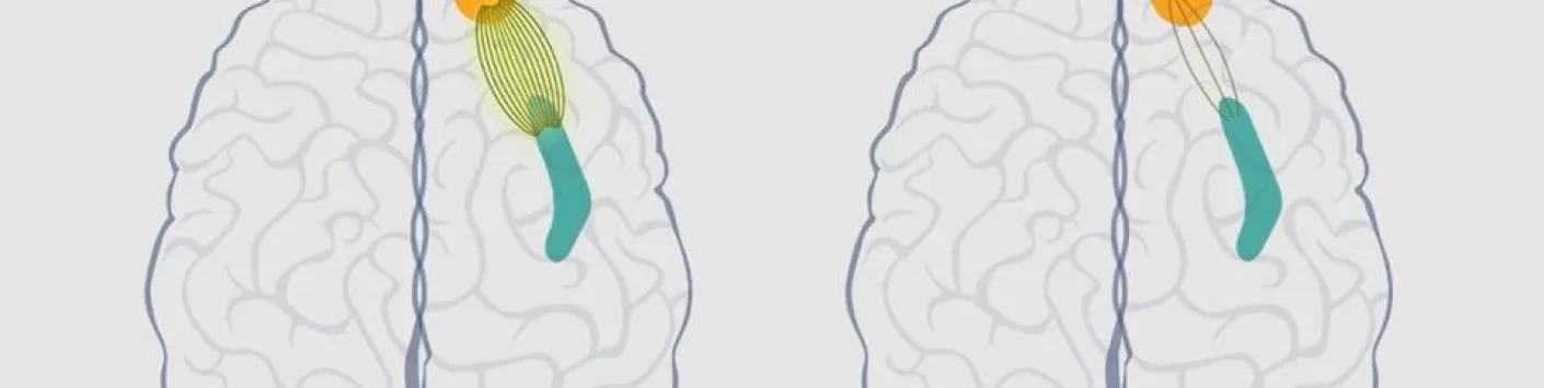 Cerveau des entrepreneurs : les chercheurs mettent en évidence une flexibilité cognitive accrue