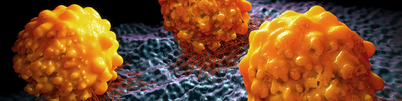 Prévenir les métastases en empêchant les cellules cancéreuses de faire du gras