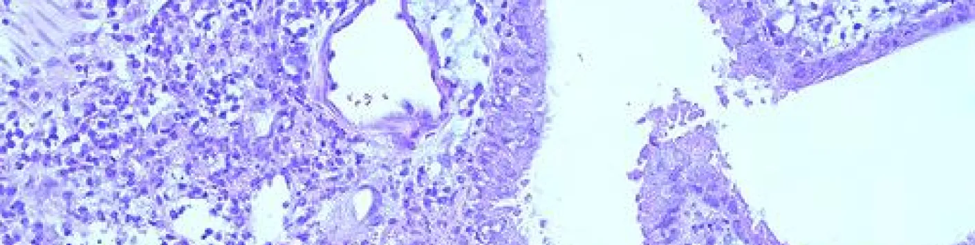 Les monocytes Ly6Chi orchestrent les réponses immunitaires face à des virus respiratoires