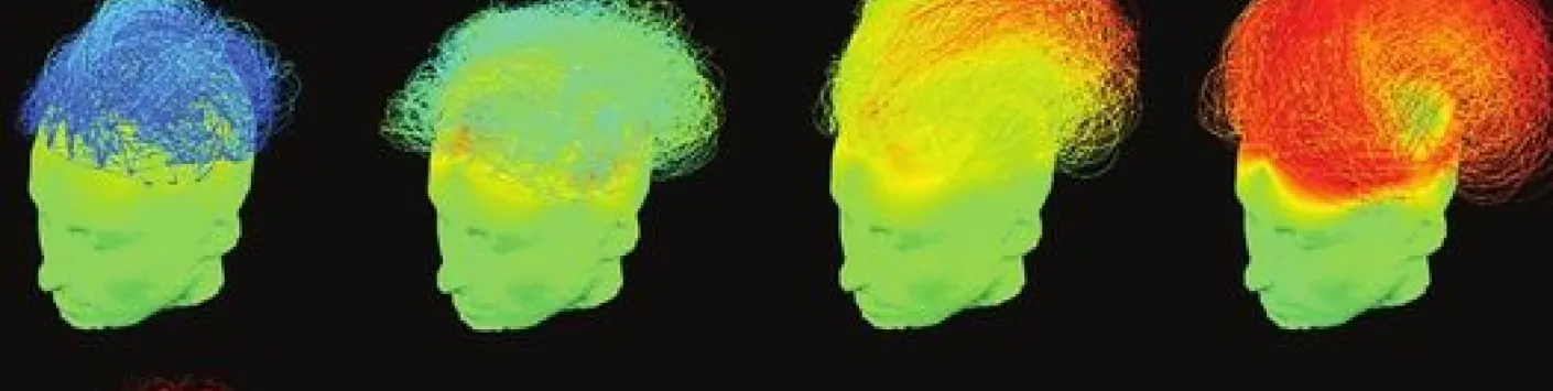 IN MEDIA ?  Le COMA SCIENCE GROUP, dirigé par Steven Laureys, Directeur de recherches FNRS, fait aujourd’hui la couverture de la revue « Annals of Neurology » ! 