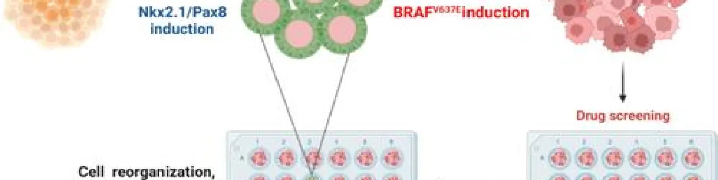 Un nouveau modèle pour étudier la tumorigenèse du cancer de la thyroïde