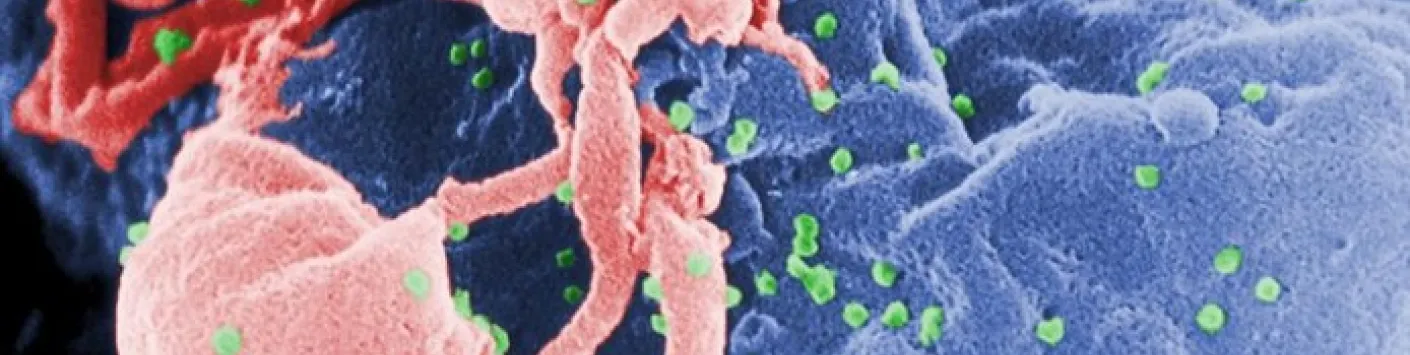 Vivre avec le virus du SIDA