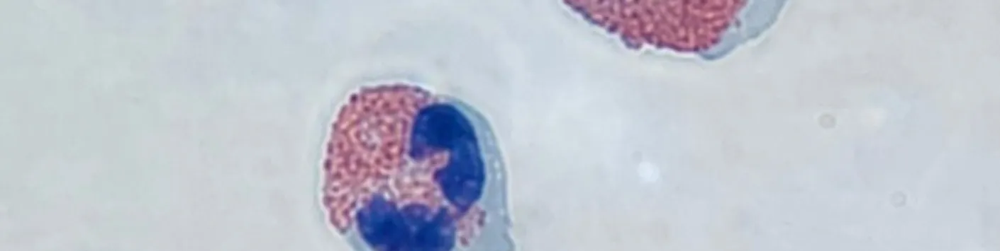 Avancées dans la compréhension des éosinophiles